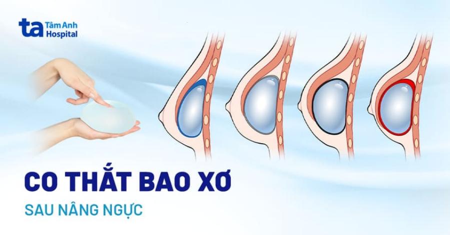 Massage Đại Phú Quận 12: Đánh Giá Chi Tiết Từ Chuyên Gia