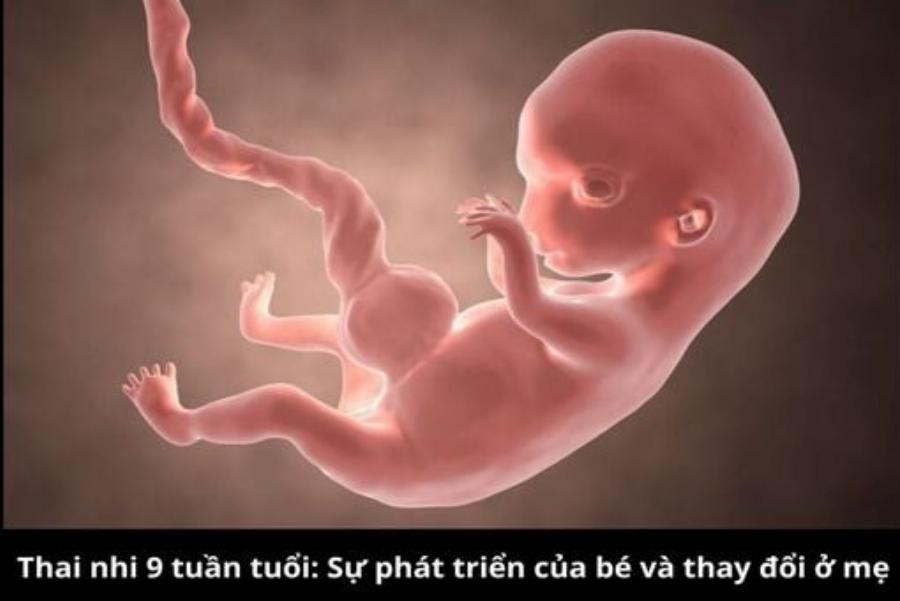 Tẩm Quất Miền Tây: Khám Phá Nghệ Thuật Thư Giãn Độc Đáo